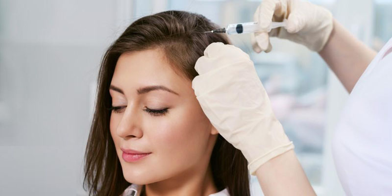 مراحل انجام مزوتراپی مو با تزریق کوکتل و ویتامین به پوست سر