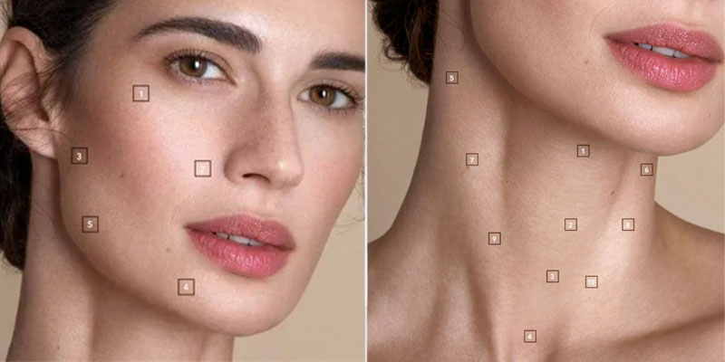 نواحی تزریق پروفایلو استراکچرا